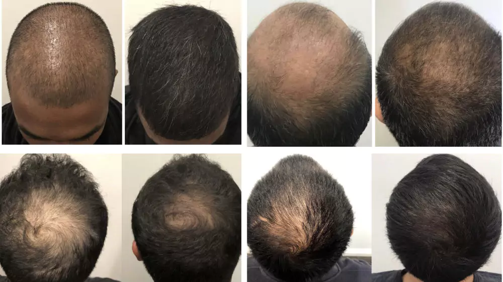Male-Before-and-After-Photo-1