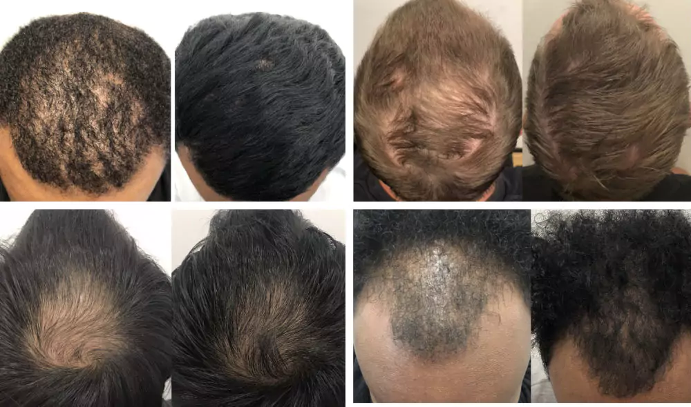 Male-Before-and-After-Photo-12