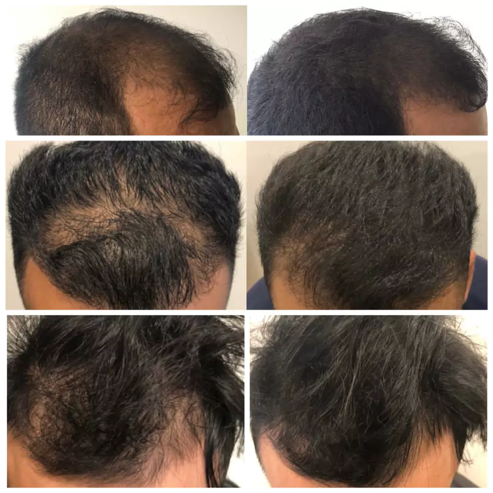 Male-Before-and-After-Photo-16