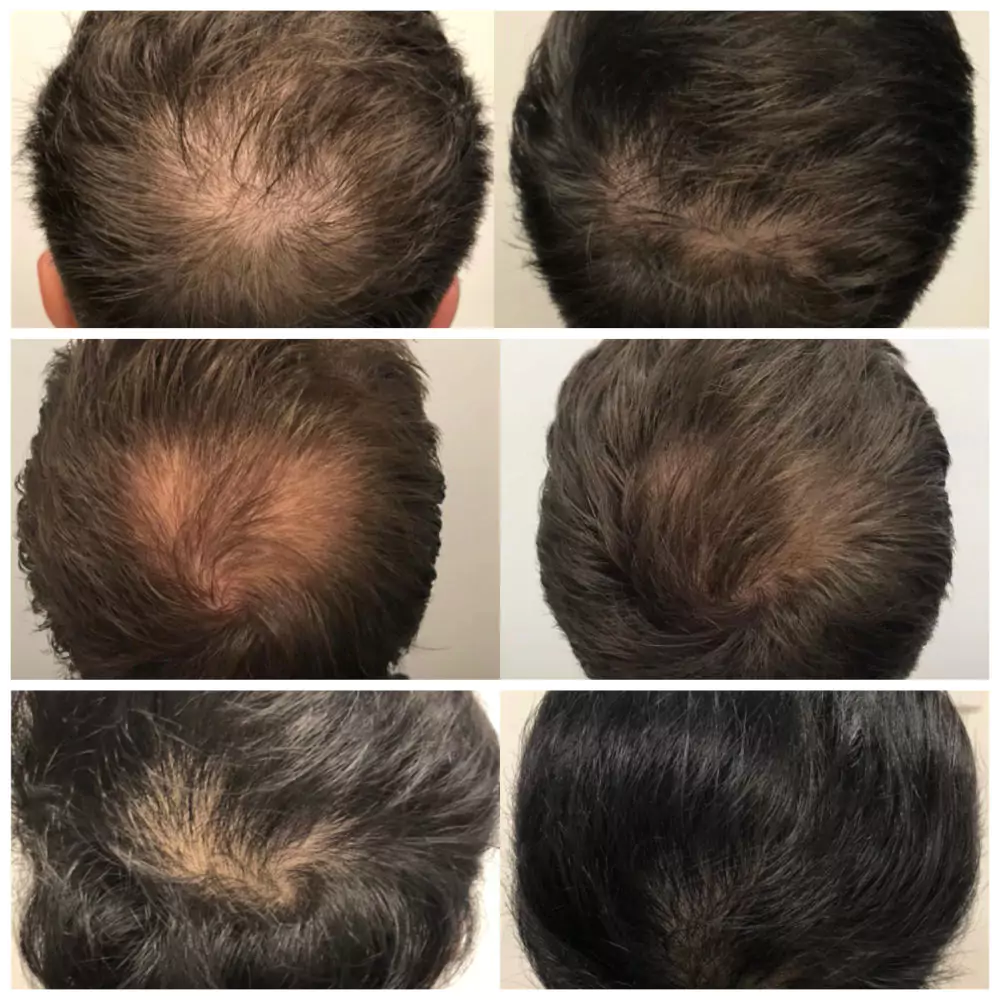 Male-Before-and-After-Photo-17