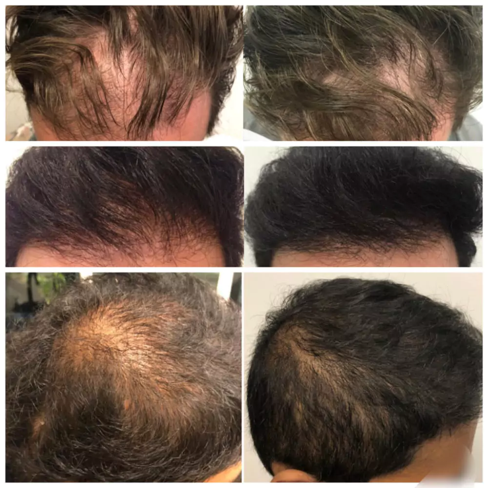 Male-Before-and-After-Photo-19