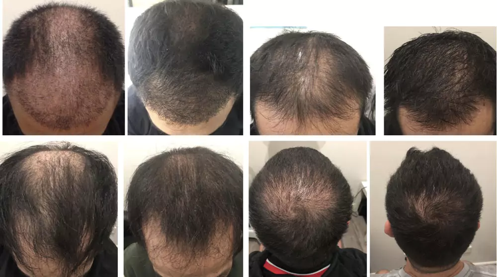 Male-Before-and-After-Photo-2