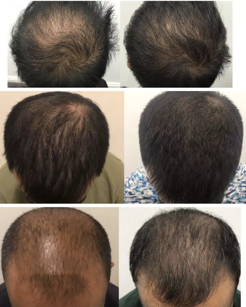 Male-Before-and-After-Photo-21