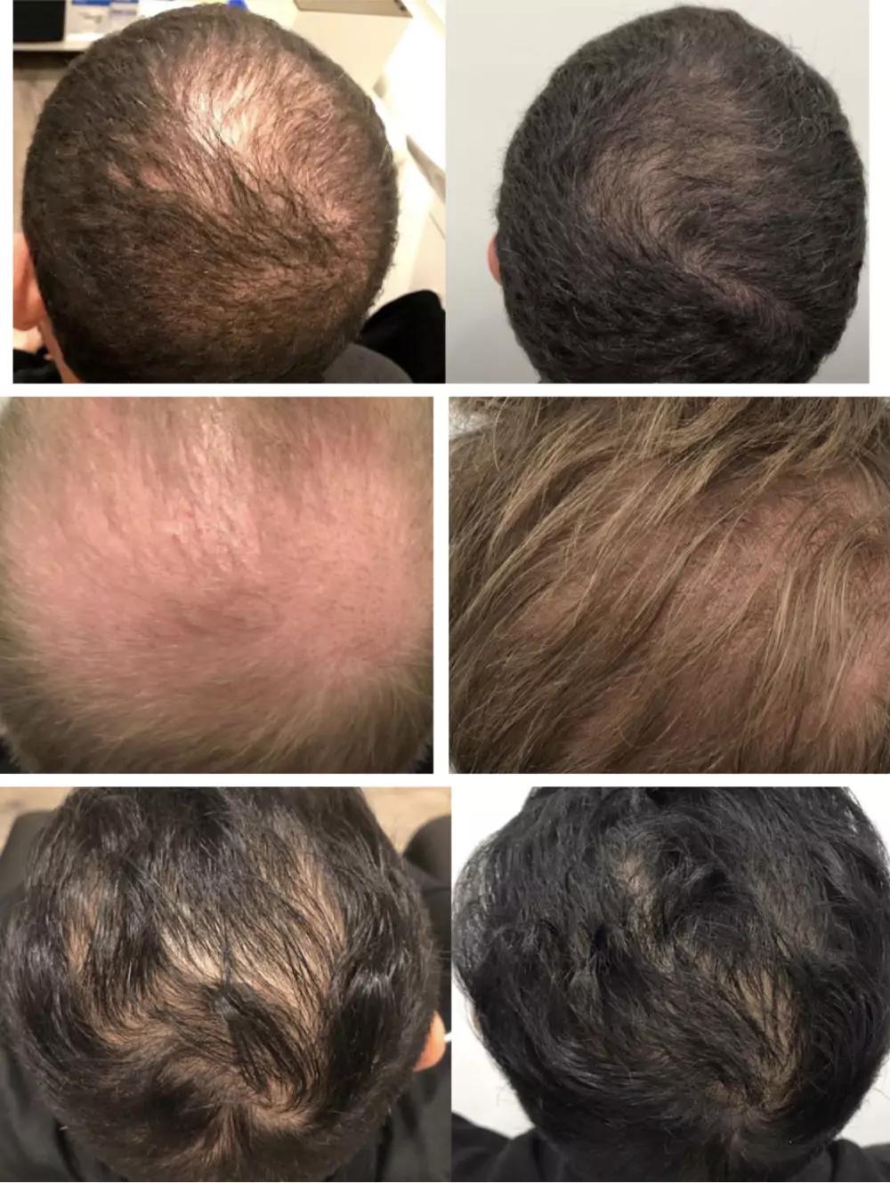 Male-Before-and-After-Photo-22