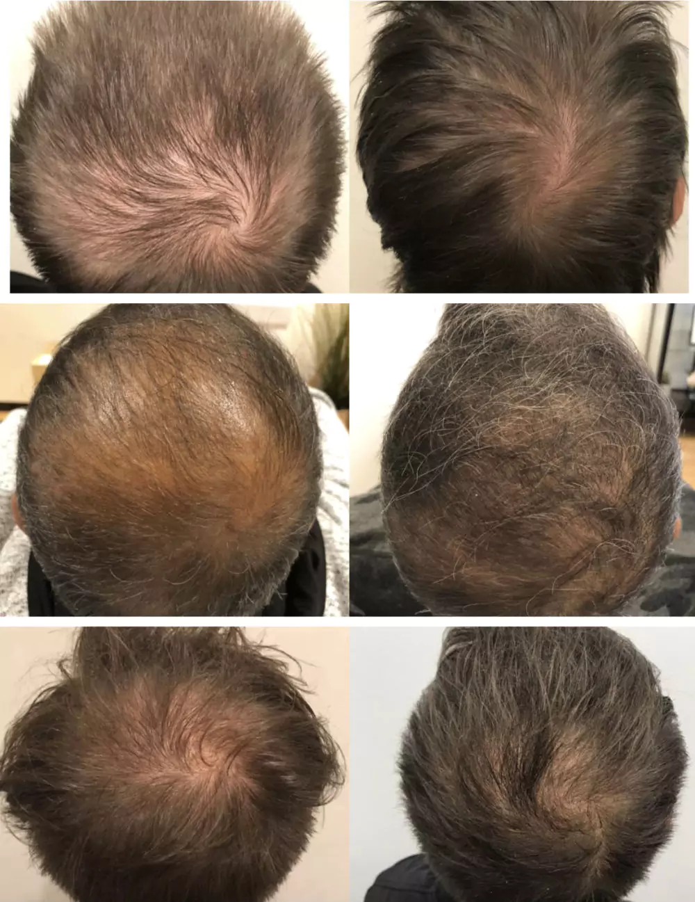 Male-Before-and-After-Photo-23