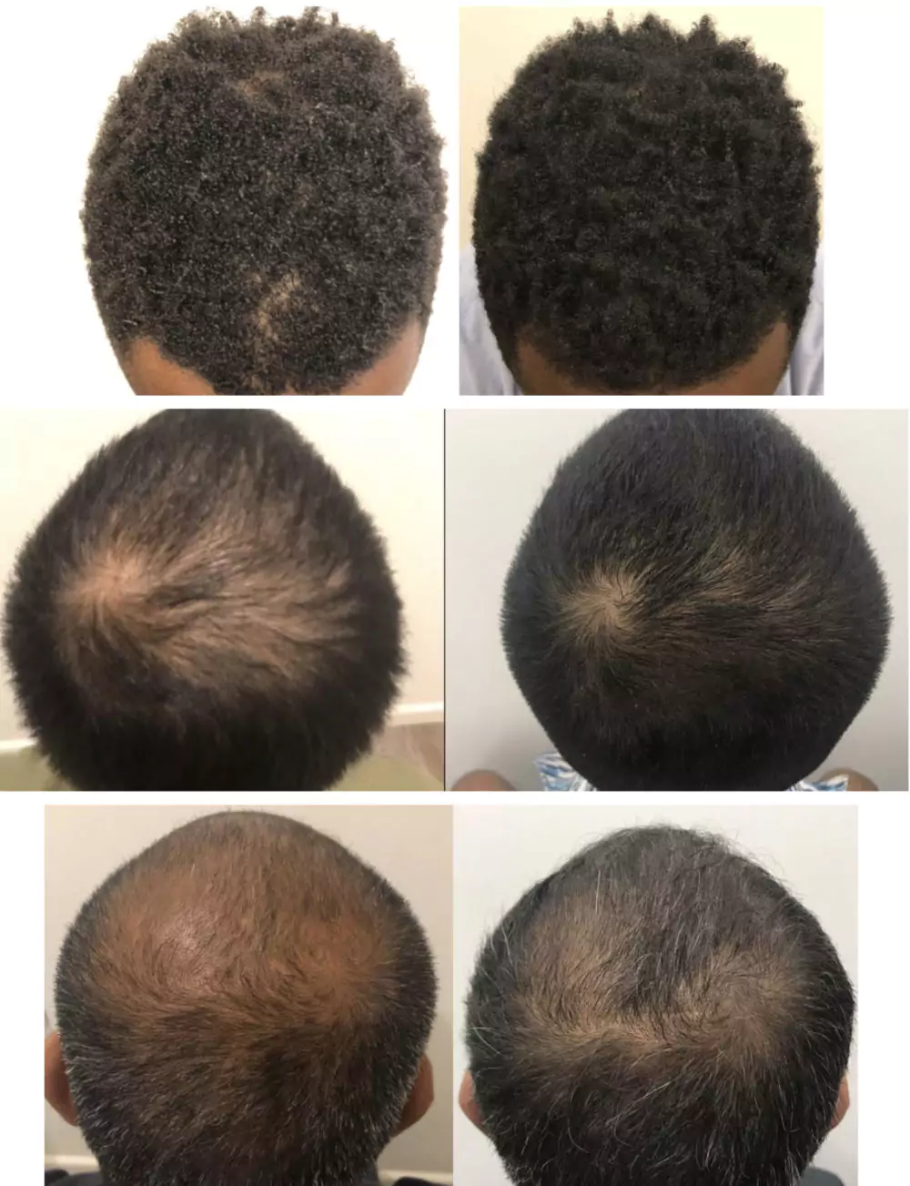 Male-Before-and-After-Photo-24