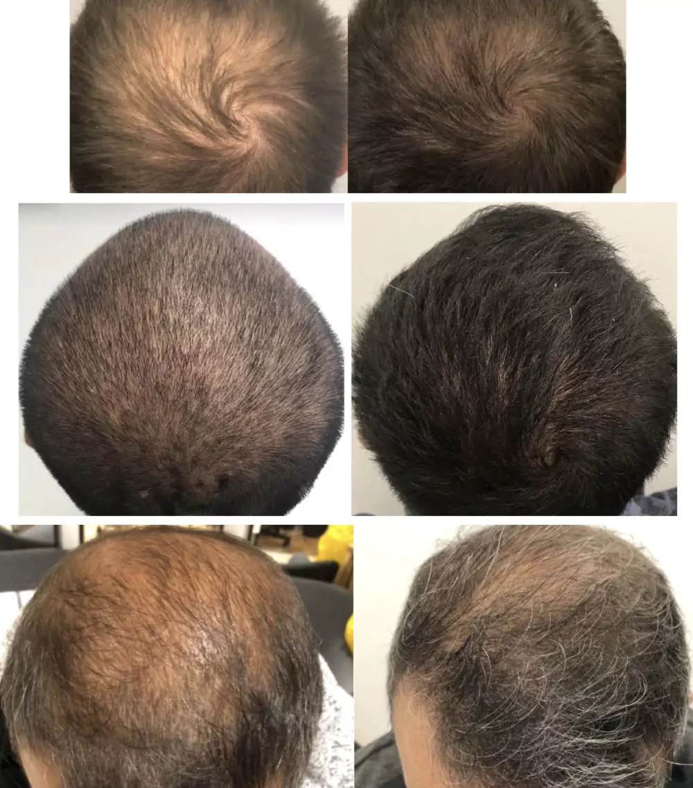 Male-Before-and-After-Photo-25