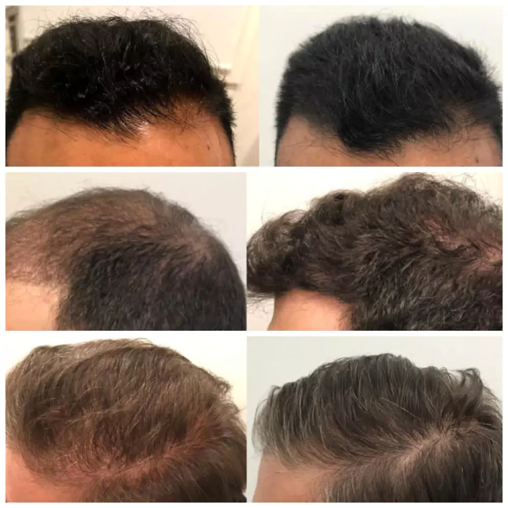 Male-Before-and-After-Photo-27