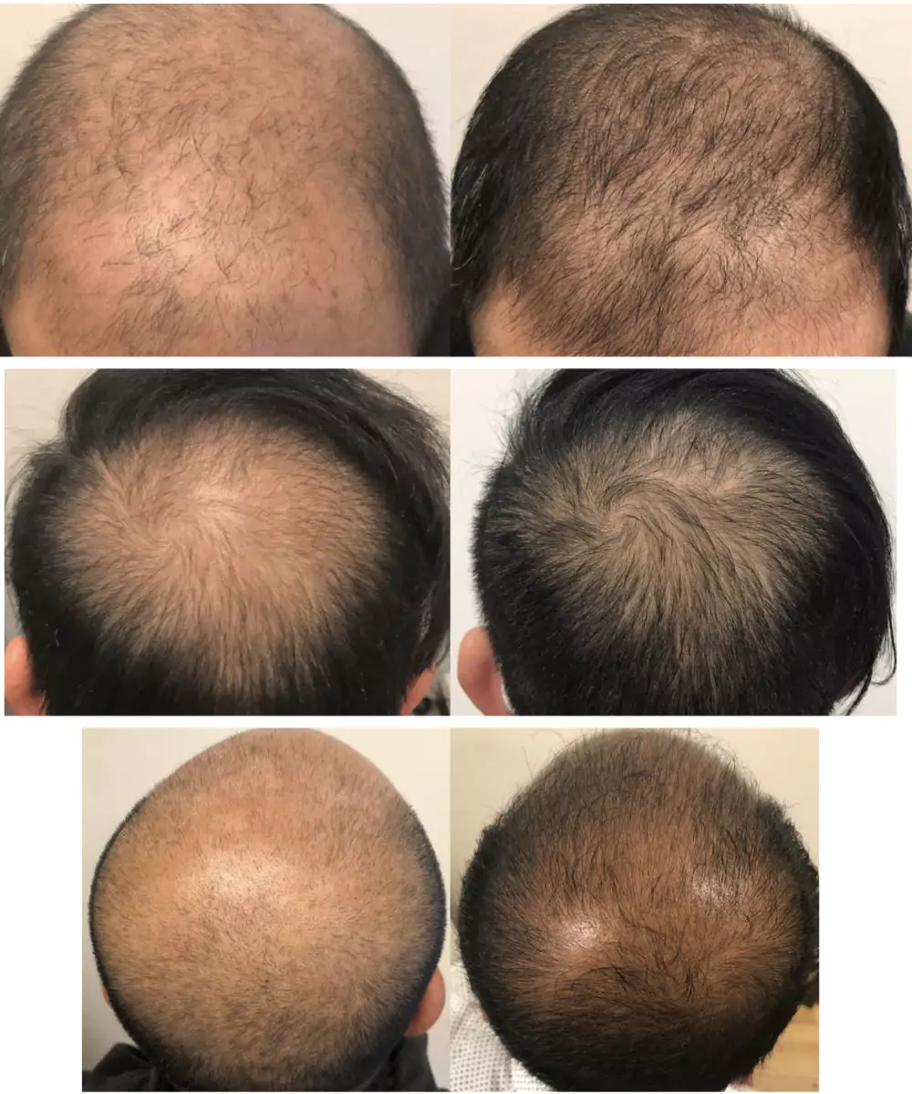 Male-Before-and-After-Photo-28