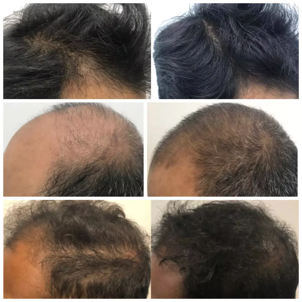 Male-Before-and-After-Photo-29