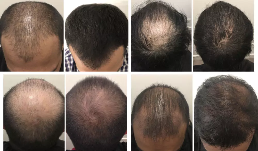 Male-Before-and-After-Photo-3
