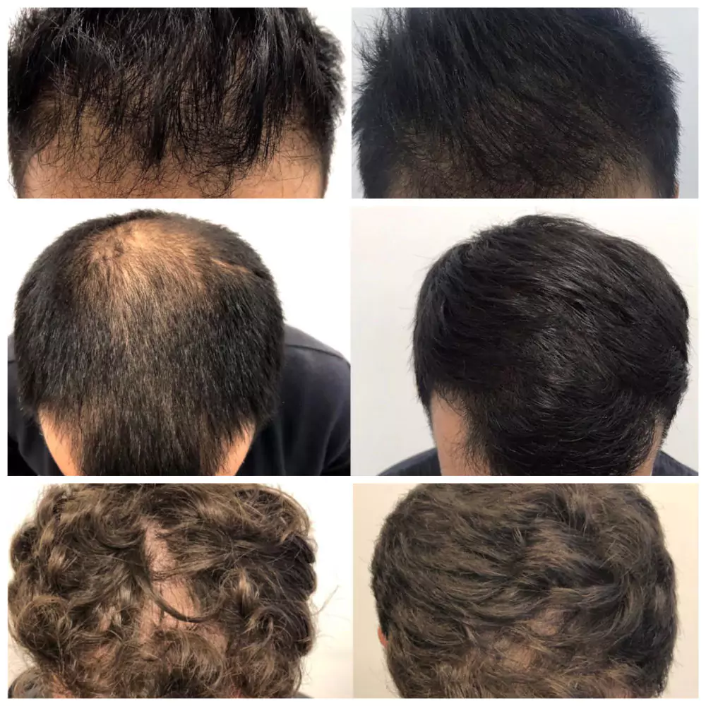 Male-Before-and-After-Photo-31
