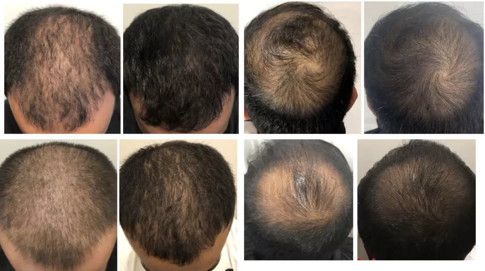 Male-Before-and-After-Photo-4