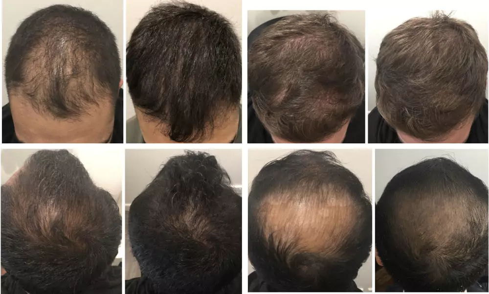 Male-Before-and-After-Photo-5