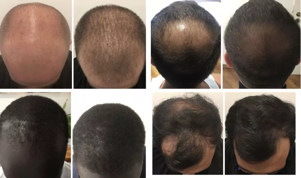 Male-Before-and-After-Photo-6