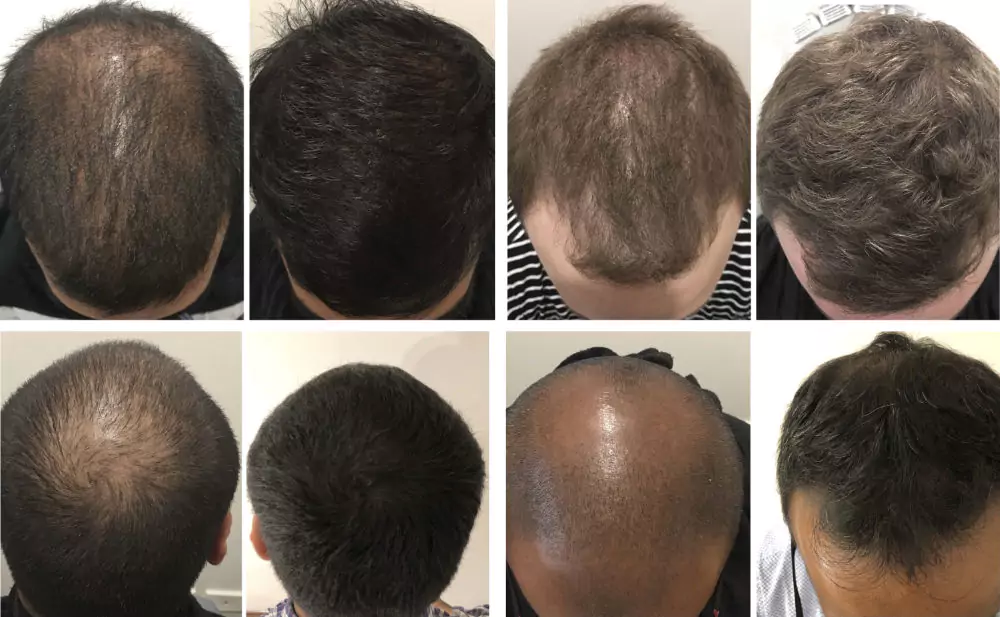 Male-Before-and-After-Photo-7