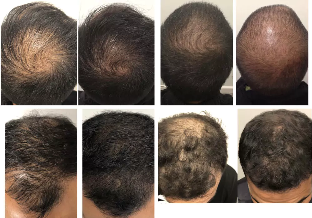 Male-Before-and-After-Photo-8