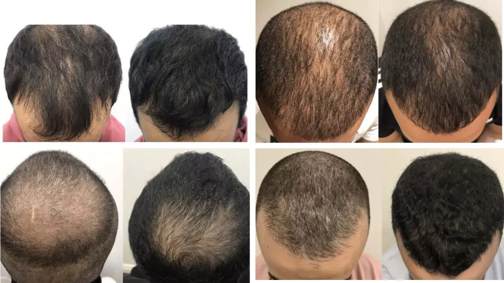 Male-Before-and-After-Photo-9