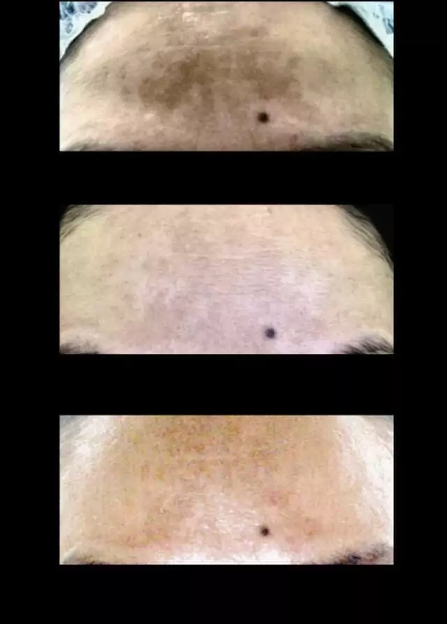 Photo 5_